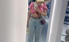 外阴病变图片集